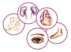 Órgãos para os quais complicações do diabetes mellitus